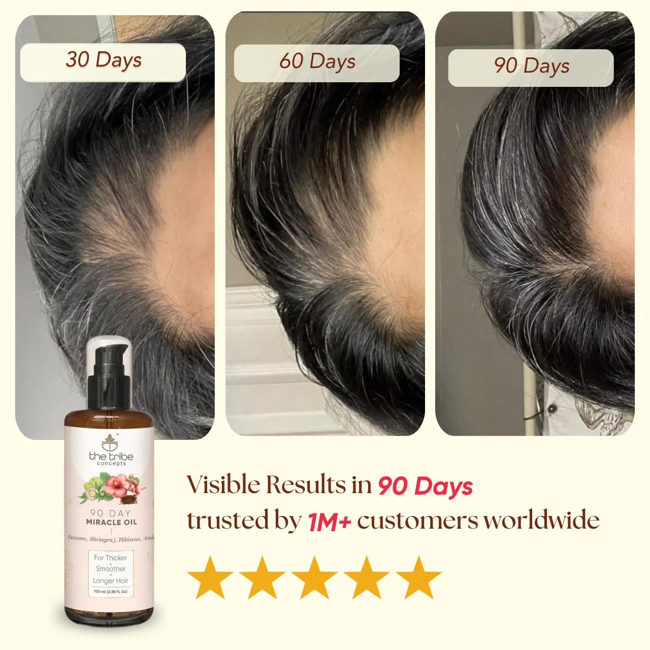 90 Day Miracle Hair Oil - Bhringraj, Amla, Hibiscus for Hairfall Control